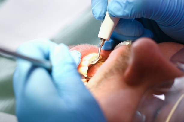 Best Pediatric Emergency Dentist in Southern Gateway, VA