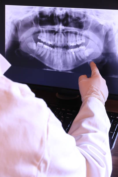 Best Emergency Dental Care for Abscessed Tooth in Southern Gateway, VA
